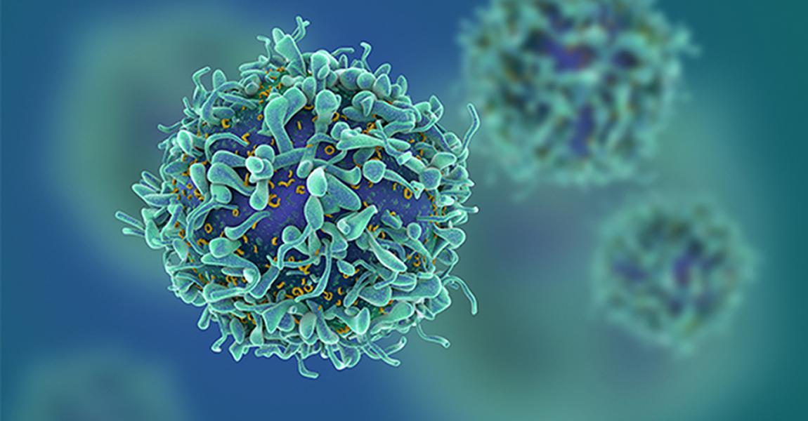 Tumor Ablation by Using Laser and Carbon Nanotubes Tumor Ablation by Using Laser and Carbon Nanotubes